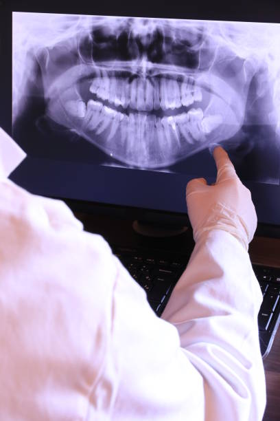 Best Emergency Gum Treatment in Flint, MI