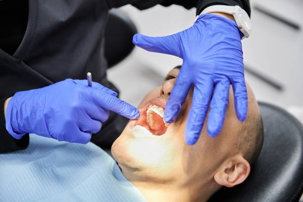 Best Emergency Treatment for Dental Infections or Abscesses in Flint, MI